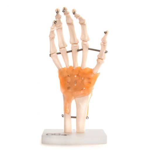 Roka z ligamenti