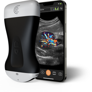 Diagnostični ultrazvok aparat