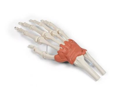 Erler Zimmer ligamentarni model zapestja