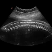 Ob fetal spine c3 hd tablet