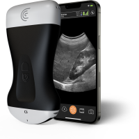 Product c3 convex handheld portable wireless ultrasound scanner