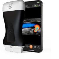 Product l15 handheld ultrasound for vascular access