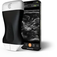 Pal scanner with phone ulnar nerve 1